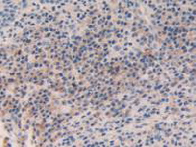 SMC3 Antibody in Immunohistochemistry (Paraffin) (IHC (P))