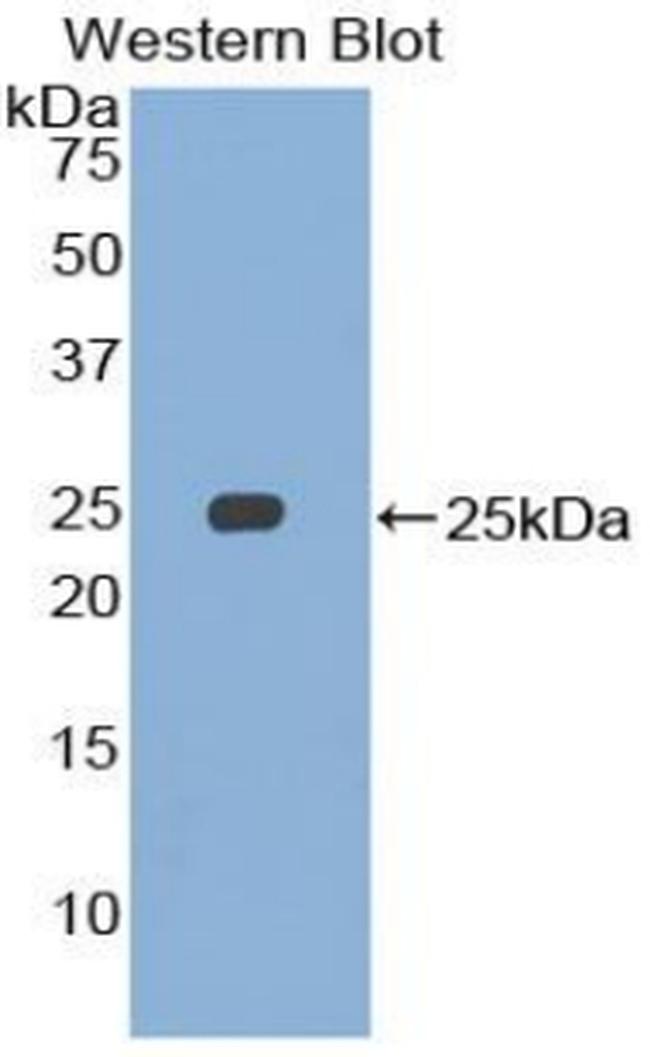 SMC3 Antibody in Western Blot (WB)