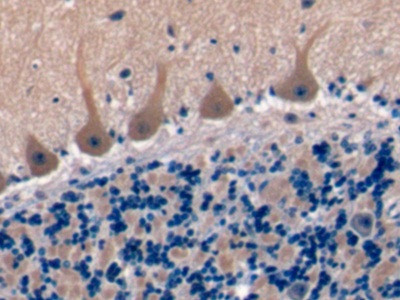 TSPAN1 Antibody in Immunohistochemistry (Paraffin) (IHC (P))