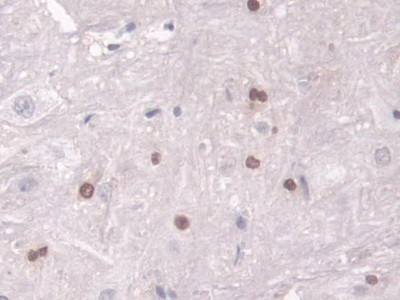 Transketolase Antibody in Immunohistochemistry (Paraffin) (IHC (P))