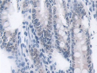 Transketolase Antibody in Immunohistochemistry (Paraffin) (IHC (P))