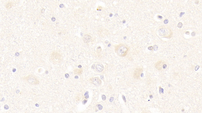 TSG Antibody in Immunohistochemistry (Paraffin) (IHC (P))