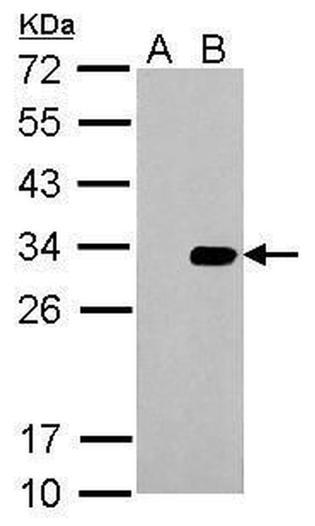 HSV Tag Antibody in Western Blot (WB)