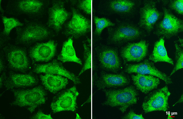 MEK1 Antibody in Immunocytochemistry (ICC/IF)