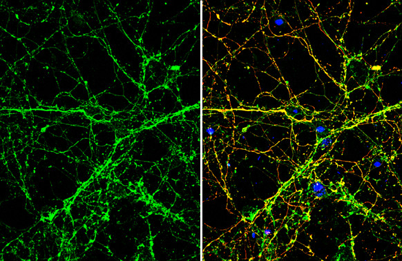 SLIT1 Antibody in Immunocytochemistry (ICC/IF)