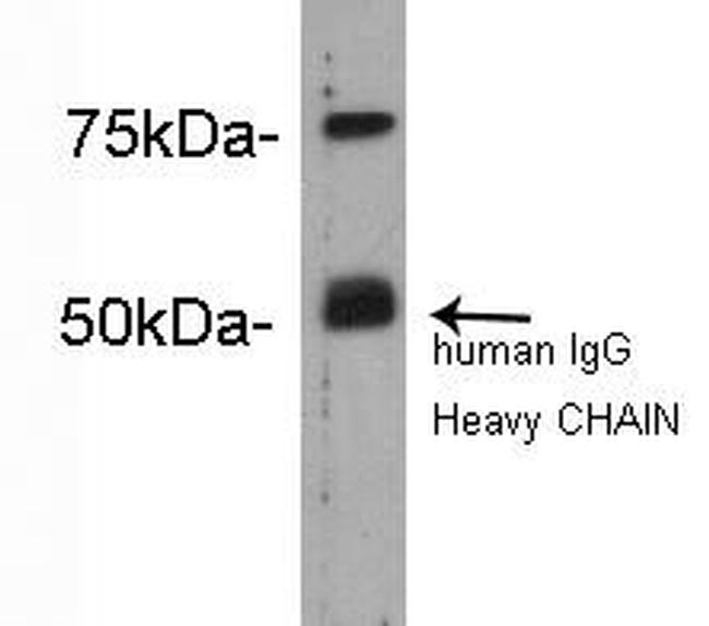 Complement C4b Antibody in Western Blot (WB)