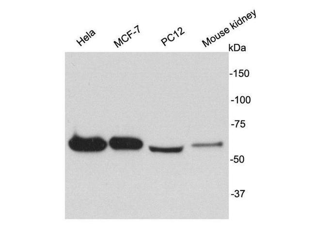 HSP60 Antibody in Western Blot (WB)