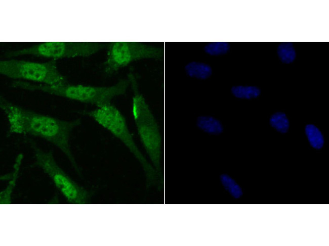 RARA Antibody in Immunocytochemistry (ICC/IF)