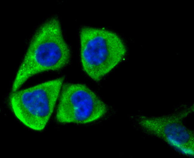 MFN2 Antibody in Immunocytochemistry (ICC/IF)