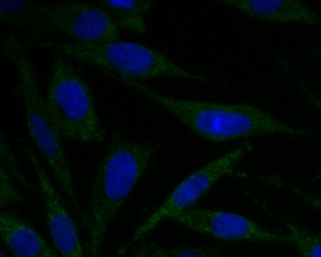 ACADM Antibody in Immunocytochemistry (ICC/IF)