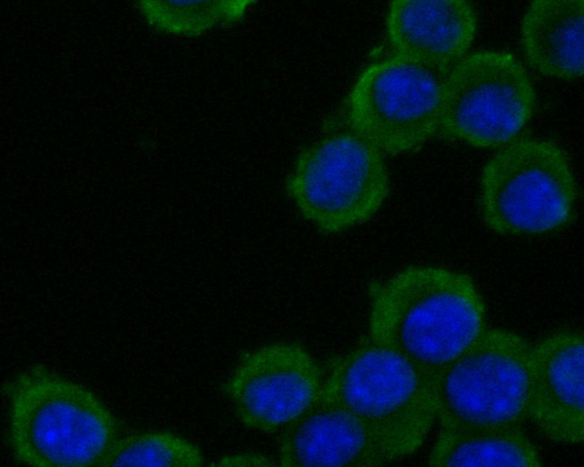 ADAM22 Antibody in Immunocytochemistry (ICC/IF)