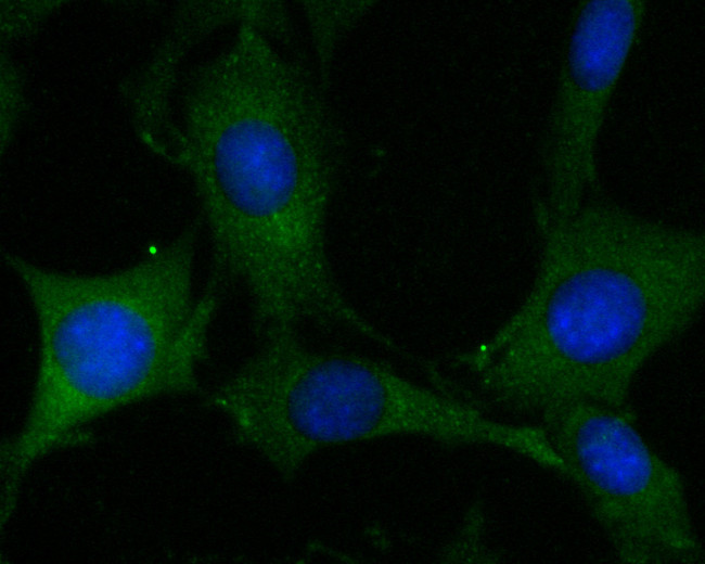 ADAM22 Antibody in Immunocytochemistry (ICC/IF)