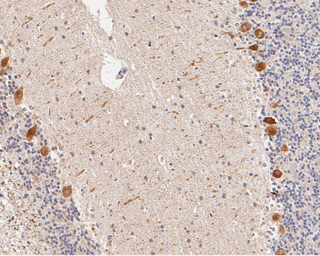 ADAM22 Antibody in Immunohistochemistry (Paraffin) (IHC (P))