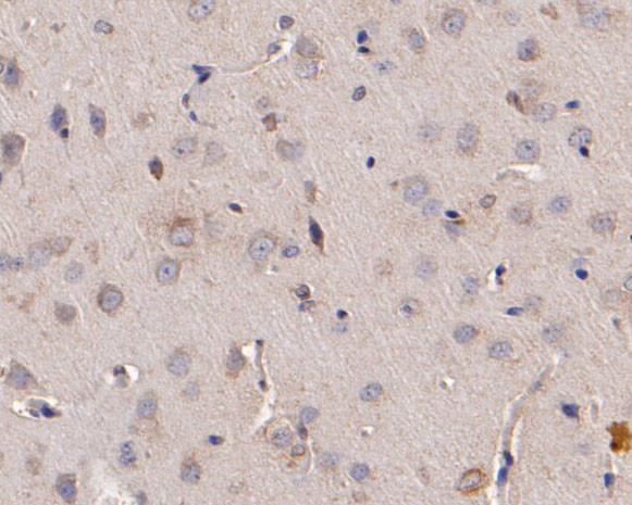 ADAM22 Antibody in Immunohistochemistry (Paraffin) (IHC (P))