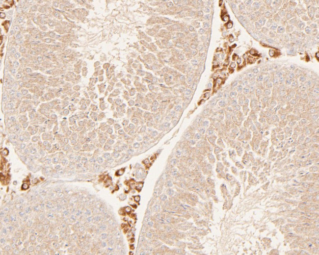 HDLBP Antibody in Immunohistochemistry (Paraffin) (IHC (P))