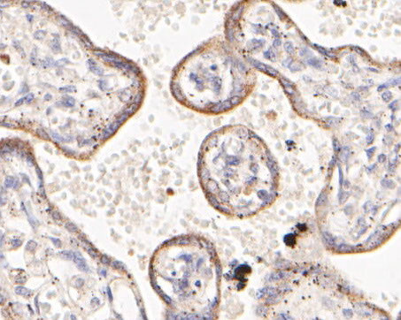 HDLBP Antibody in Immunohistochemistry (Paraffin) (IHC (P))