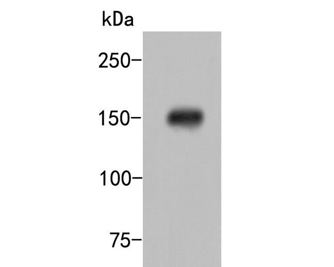 HDLBP Antibody in Western Blot (WB)