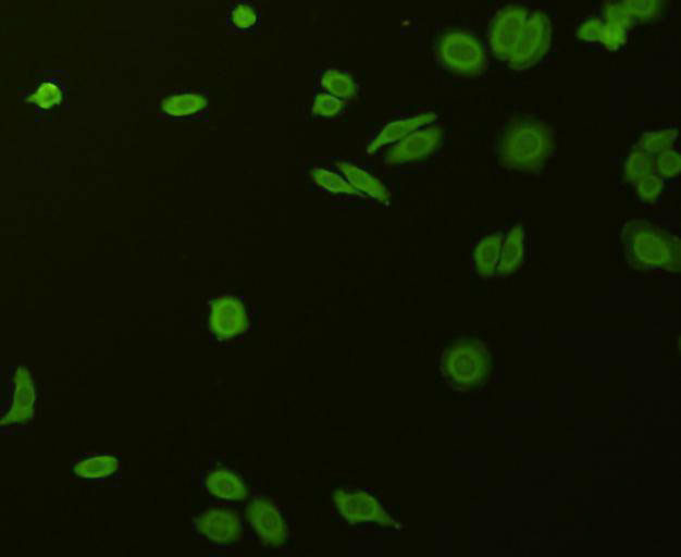 STAT1 alpha/beta Antibody in Immunocytochemistry (ICC/IF)