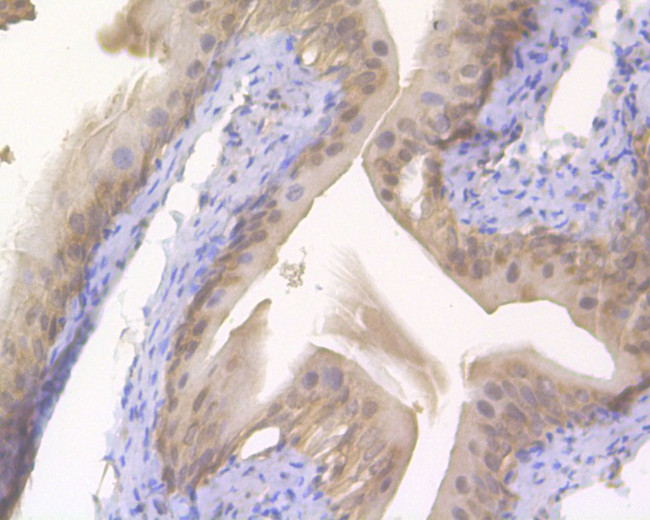 S100A2 Antibody in Immunohistochemistry (Paraffin) (IHC (P))