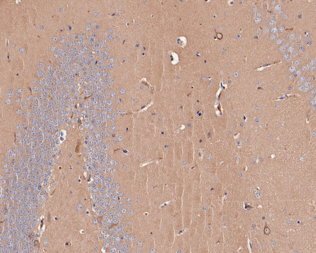 RALA Antibody in Immunohistochemistry (Paraffin) (IHC (P))