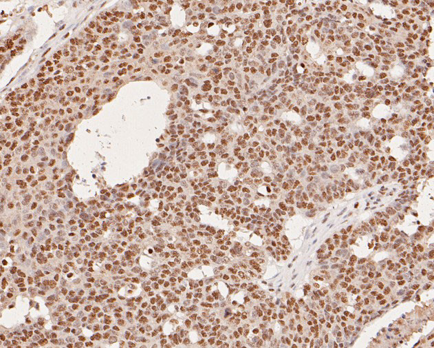 THOC5 Antibody in Immunohistochemistry (Paraffin) (IHC (P))