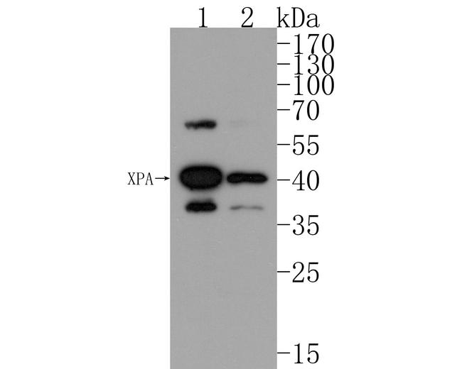 XPA Antibody in Western Blot (WB)
