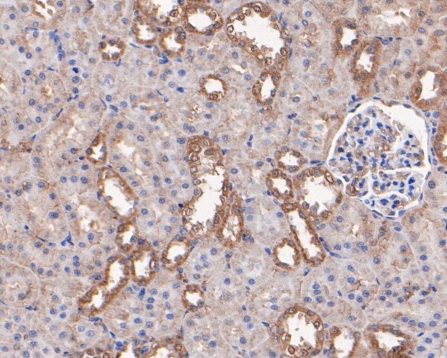 ERAB Antibody in Immunohistochemistry (Paraffin) (IHC (P))