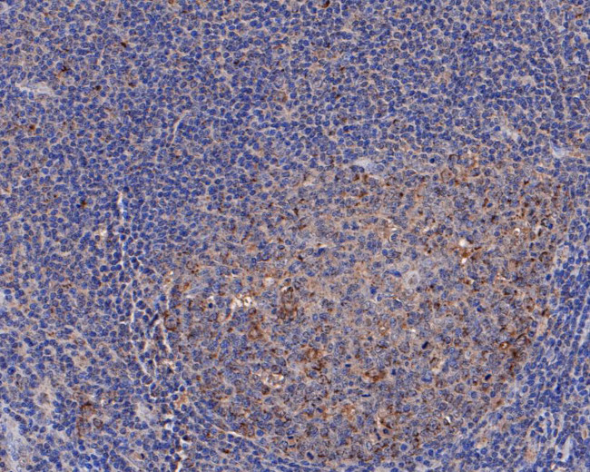 ERAB Antibody in Immunohistochemistry (Paraffin) (IHC (P))