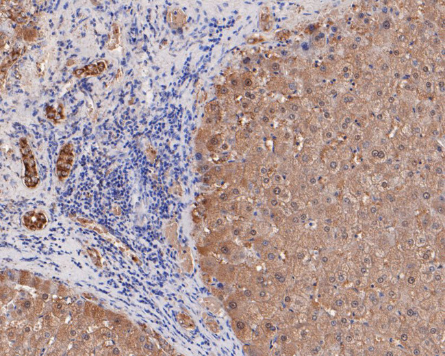 ERAB Antibody in Immunohistochemistry (Paraffin) (IHC (P))