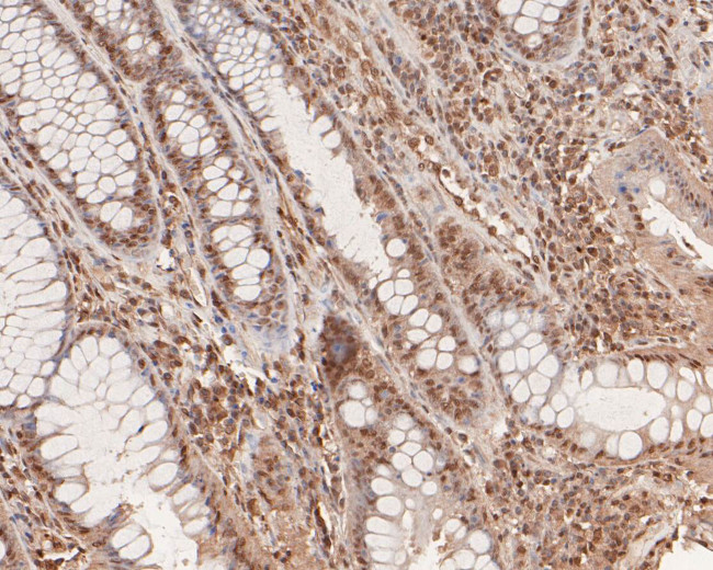 SNRPD3 Antibody in Immunohistochemistry (Paraffin) (IHC (P))