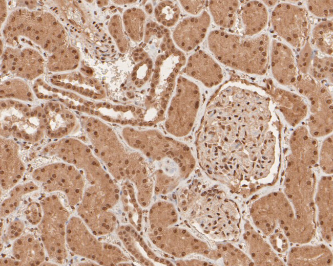 SNRPD3 Antibody in Immunohistochemistry (Paraffin) (IHC (P))