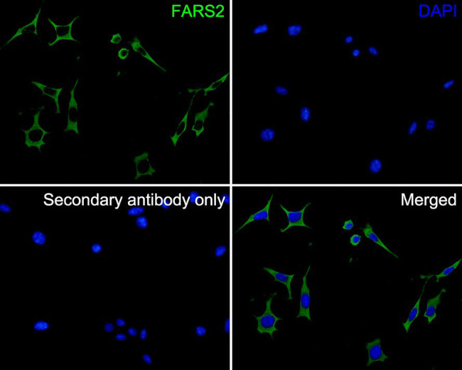 FARS2 Antibody in Immunocytochemistry (ICC/IF)