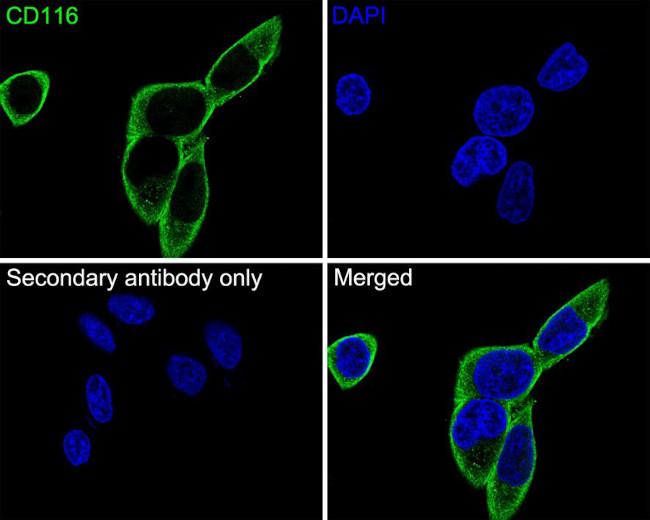 CD116 Antibody in Immunocytochemistry (ICC/IF)