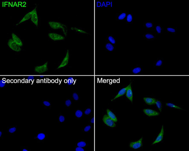 IFNAR2 Antibody in Immunocytochemistry (ICC/IF)