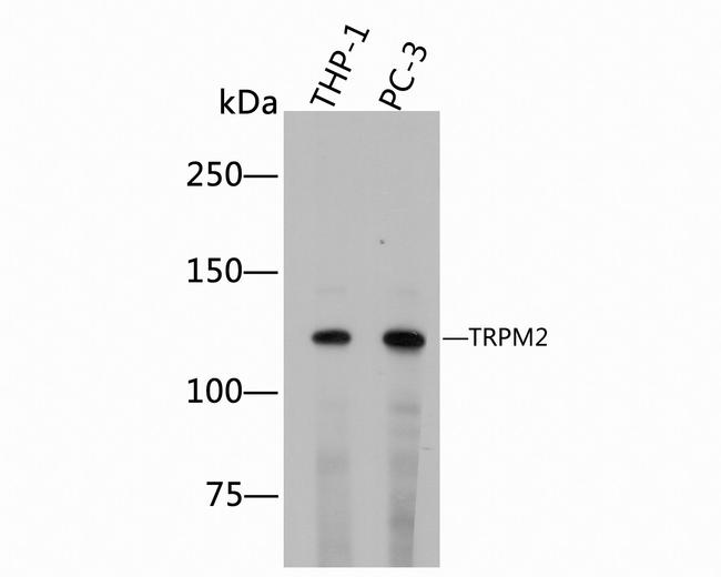 TRPM2 Antibody in Western Blot (WB)