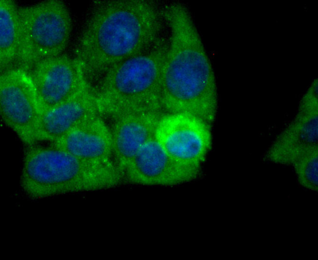 ALDH1A1 Antibody in Immunocytochemistry (ICC/IF)