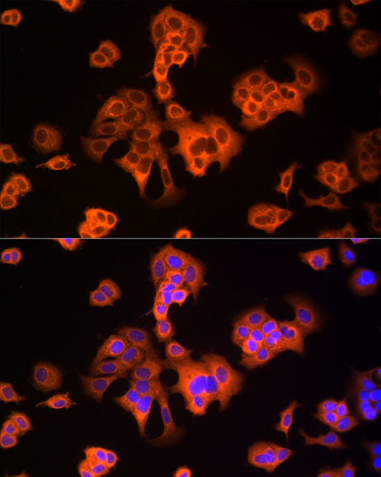 NRG1 Antibody in Immunocytochemistry (ICC/IF)