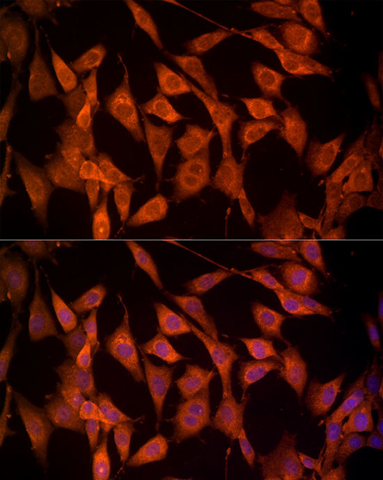 NRG1 Antibody in Immunocytochemistry (ICC/IF)