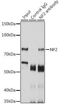NF2 Antibody in Immunoprecipitation (IP)