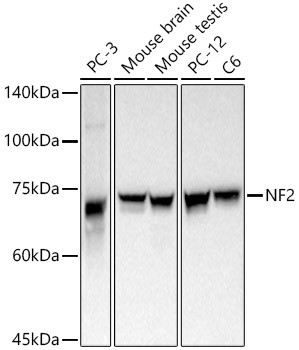NF2 Antibody in Western Blot (WB)