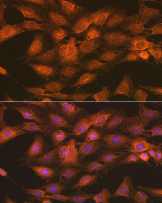 IKK gamma Antibody in Immunocytochemistry (ICC/IF)