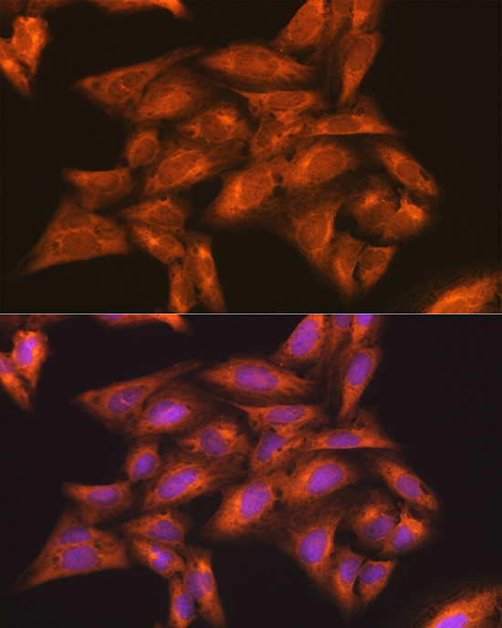 IKK gamma Antibody in Immunocytochemistry (ICC/IF)