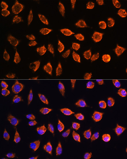 NOTCH3 Antibody in Immunocytochemistry (ICC/IF)