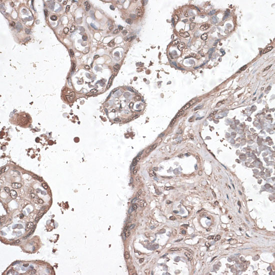 MEF2C Antibody in Immunohistochemistry (Paraffin) (IHC (P))