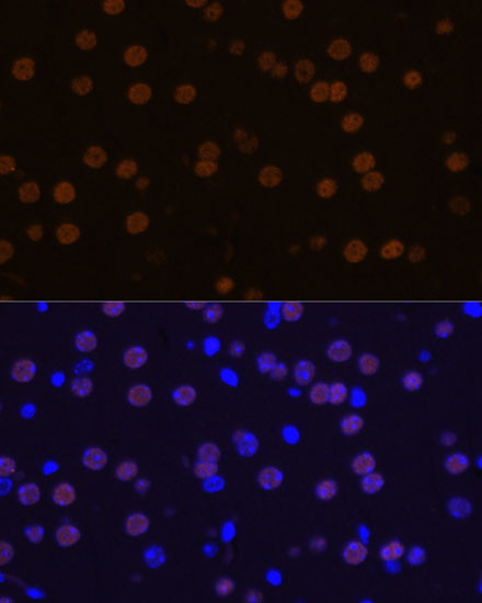 MEF2C Antibody in Immunohistochemistry (Paraffin) (IHC (P))