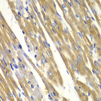 Tyrosinase Antibody in Immunohistochemistry (Paraffin) (IHC (P))