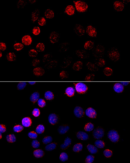 Aromatase Antibody in Immunocytochemistry (ICC/IF)