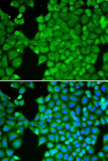 Carbonic Anhydrase III Antibody in Immunocytochemistry (ICC/IF)