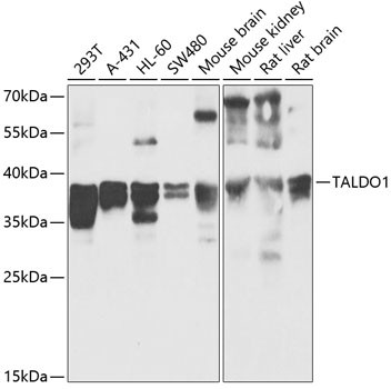 TALDO1 Antibody in Western Blot (WB)