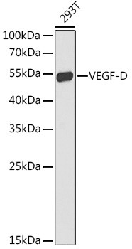 VEGFD Antibody in Western Blot (WB)